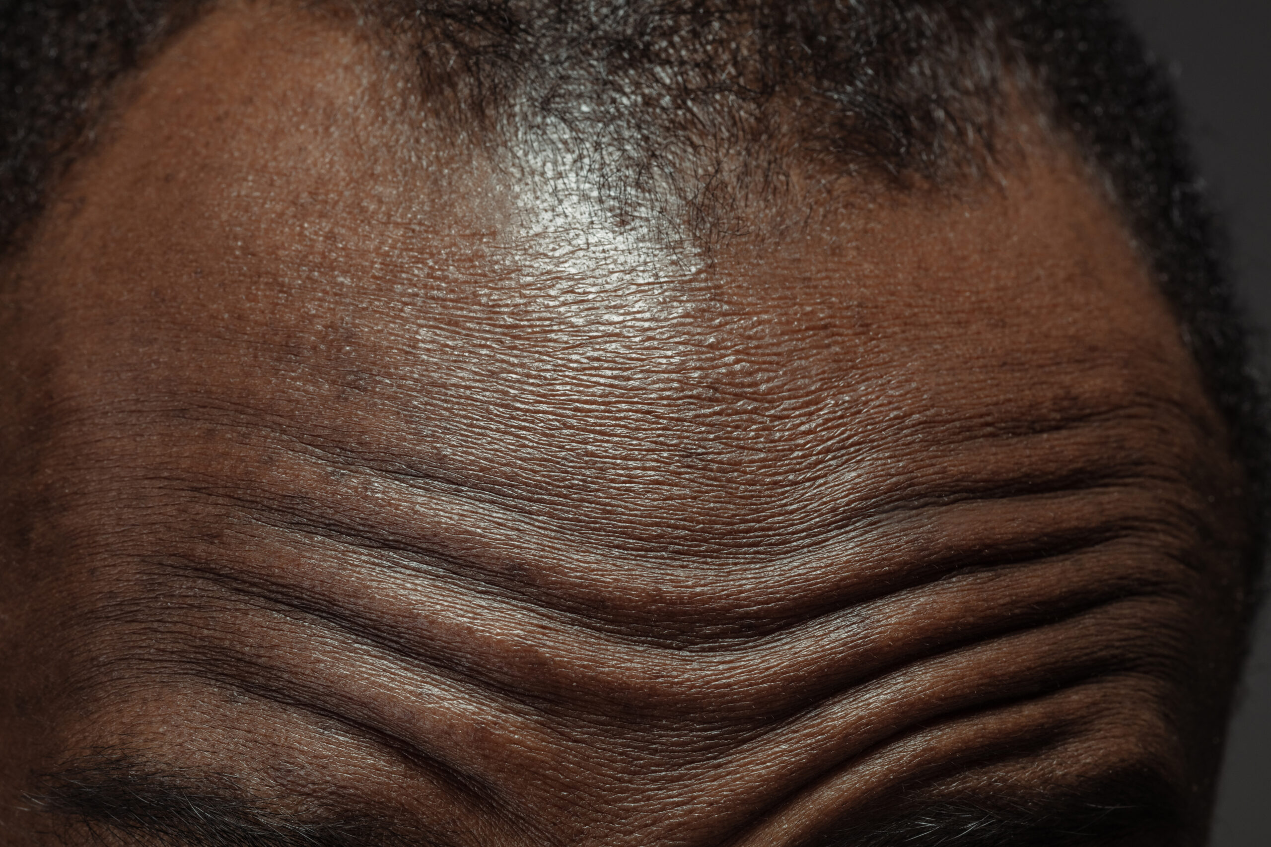 Head, face. Detailed texture of human skin. Close up shot of young african-american male body. Skincare, bodycare, healthcare, hygiene and medicine concept. Looks beauty and well-kept. Dermatology.